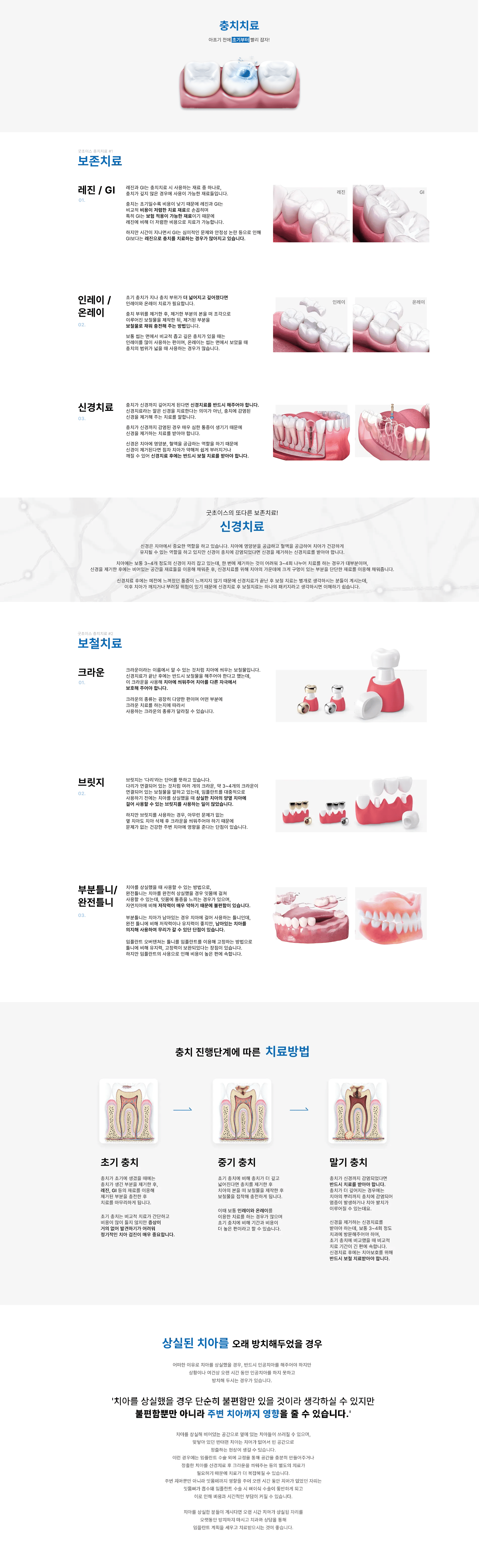 굿초이스치과 충치치료 진행 안내
